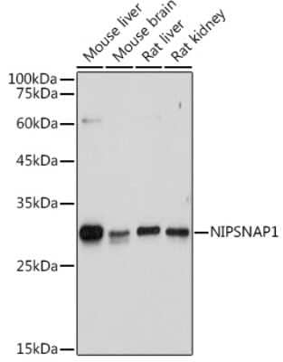 Western Blot: NIPSNAP1 Antibody [NBP3-05243] - Western blot analysis of extracts of various cell lines, using NIPSNAP1 antibody (NBP3-05243) at 1:1000 dilution. Secondary antibody: HRP Goat Anti-Rabbit IgG (H+L) at 1:10000 dilution. Lysates/proteins: 25ug per lane. Blocking buffer: 3% nonfat dry milk in TBST. Detection: ECL Basic Kit. Exposure time: 3s.